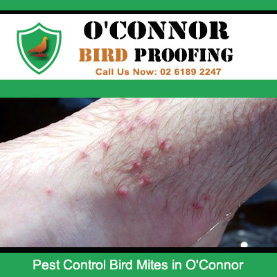 Bird mite skin irritation requiring pest control in O'Connor